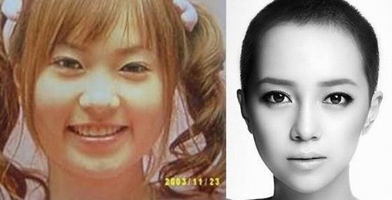 เผยภาพ 20 ภาพสาวเกาหลี ก่อน-หลัง ทำศัลยกรรม เหมือนได้ชีวิตใหม่เลย (18)
