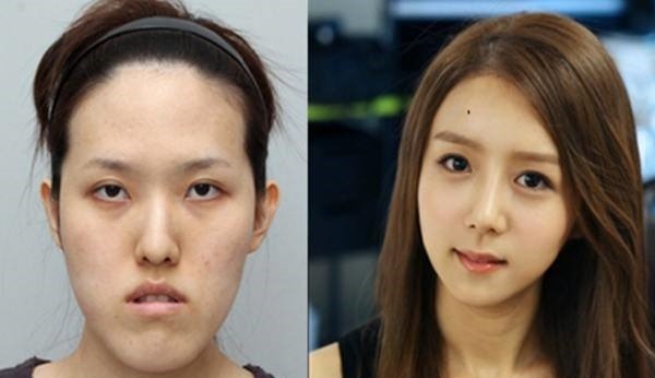 เผยภาพ 20 ภาพสาวเกาหลี ก่อน-หลัง ทำศัลยกรรม เหมือนได้ชีวิตใหม่เลย (2)
