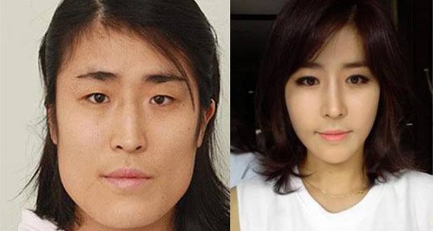 เผยภาพ 20 ภาพสาวเกาหลี ก่อน-หลัง ทำศัลยกรรม เหมือนได้ชีวิตใหม่เลย (8)