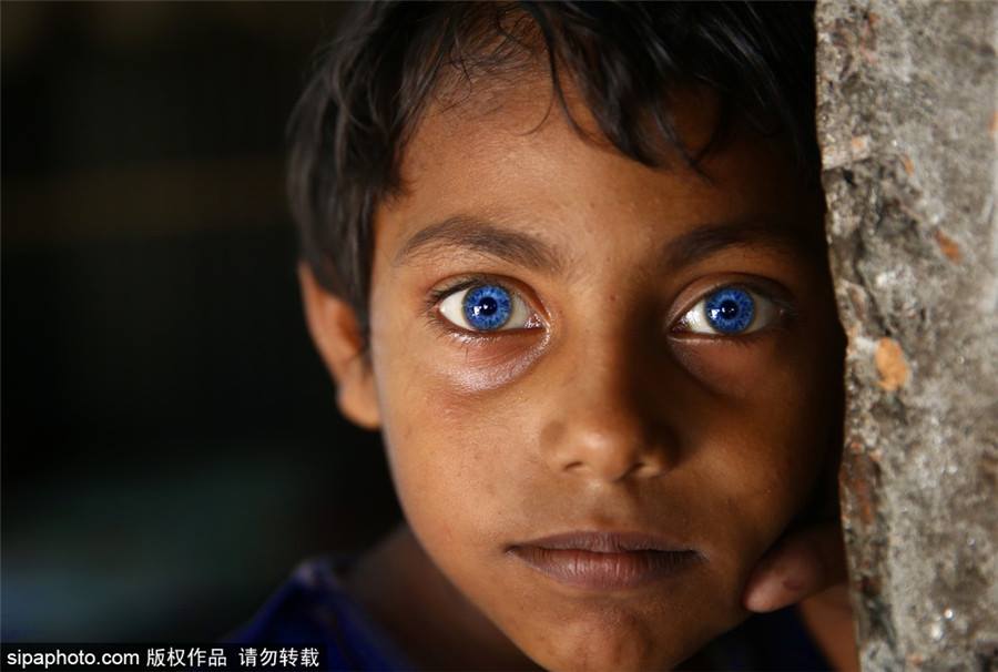 OMG! เด็กชายบังคลาเทศ ผู้มีดวงตาเป็นสีฟ้าเหมือนไพลิน สวยมากๆ (1)