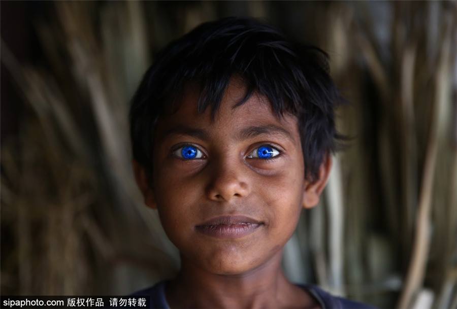 OMG! เด็กชายบังคลาเทศ ผู้มีดวงตาเป็นสีฟ้าเหมือนไพลิน สวยมากๆ (3)