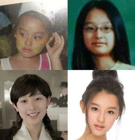 สวยตั้งแต่เด็ก Kim Ji Won หรือ ยุนมยองจู Descendants of the Sun (28)